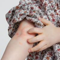 CSM - Healthy Skin Guide - Complete Health Survey/Registration
