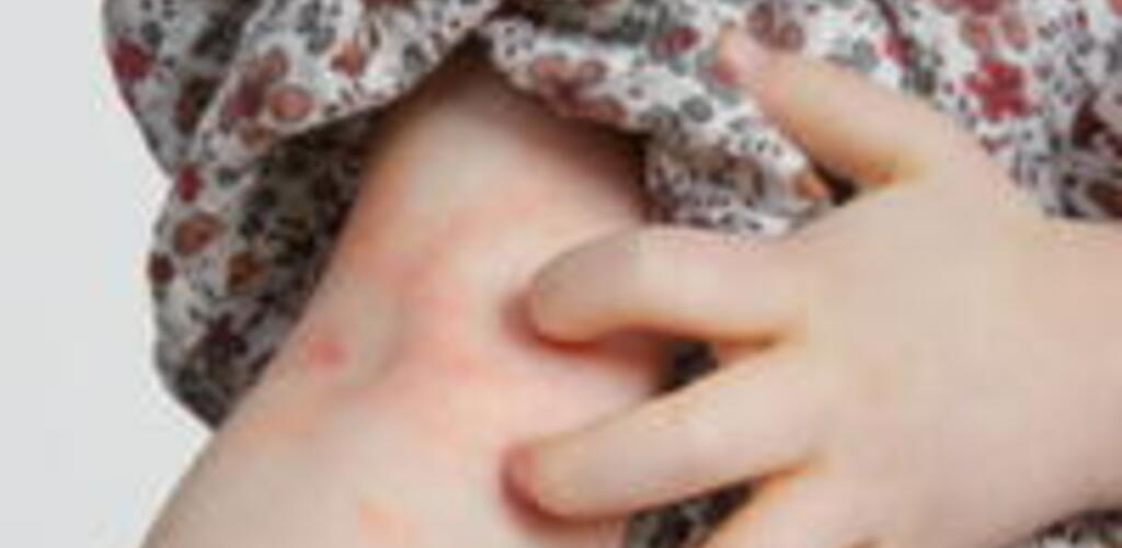 Healthy Skin Guide - Complete Health Survey/Registration